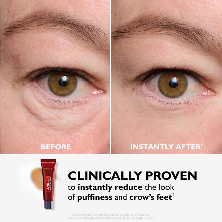 🔥 Last 3 Hours 50% OFF ✨ BUY 1 GET 1 FREE🔥Eye Bag Eraser — Instantly Refreshes, Firms & Smooths for a Youthful Look That Lasts 8 Hours