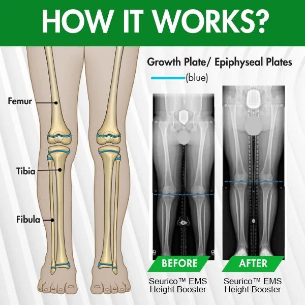 Seurico™ EMS Height Booster