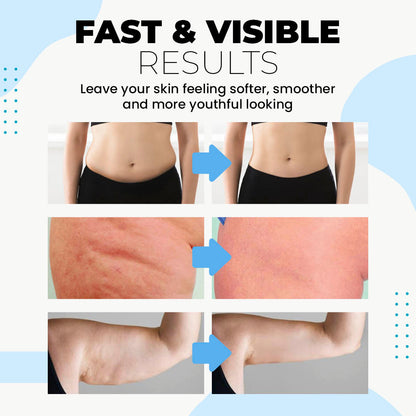 Seurico™ Collagen Revitalizing Strips