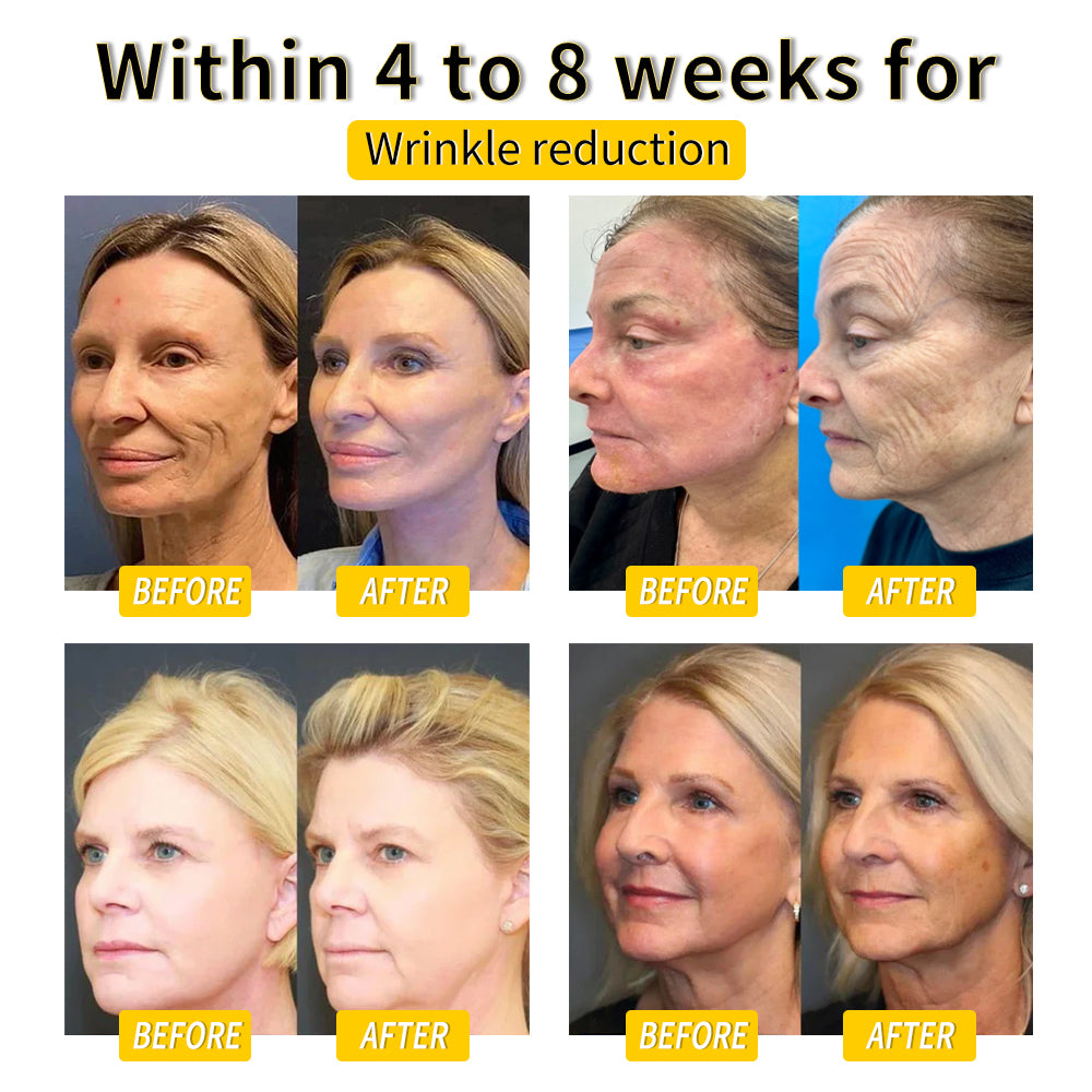 Cvreoz™ Bee Venom Lymphatic Drainage & Skin Firming Slimming Cream