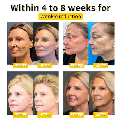 Cvreoz™ Bee Venom Lymphatic Drainage & Skin Firming Slimming Cream