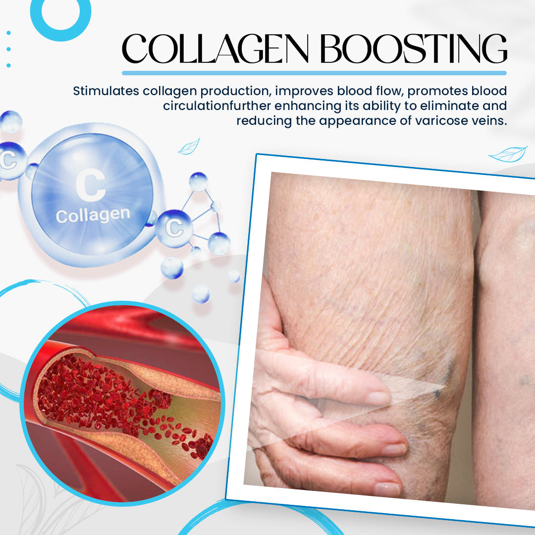Seurico™Varicose Veins Treatment Cream ✅ Dermatologist Recommended