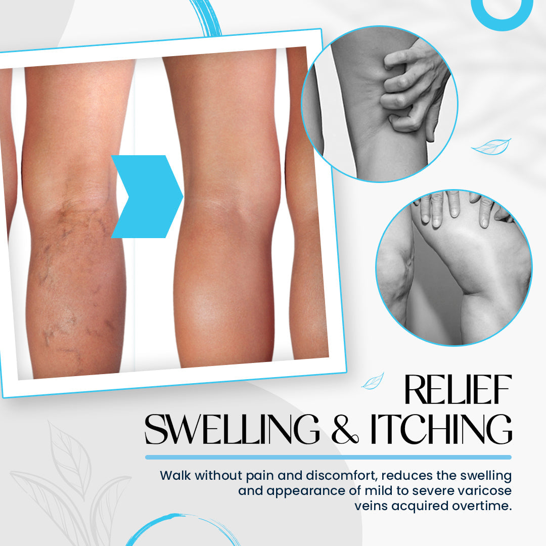 Seurico™Varicose Veins Treatment Cream ✅ Dermatologist Recommended