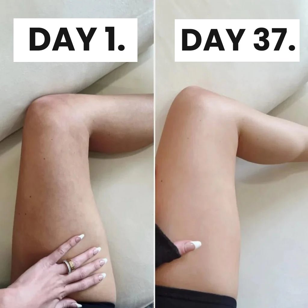 JEREMYTIS™ Cellulite Relief Kit