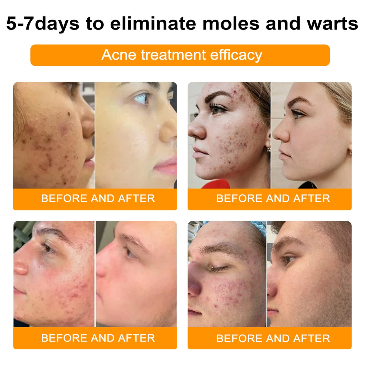 （🍀 Last Day 80% Off🍀）AQA™ Bee Venom  Therapy Cream