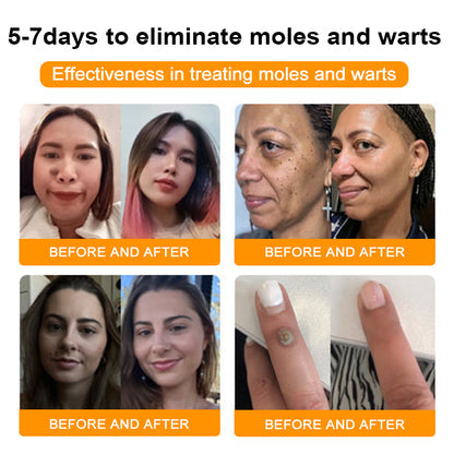 （🍀 Last Day 80% Off🍀）AQA™ Bee Venom  Therapy Cream