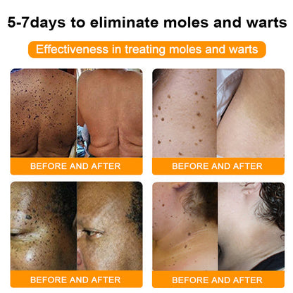 （🍀 Last Day 80% Off🍀）AQA™ Bee Venom  Therapy Cream