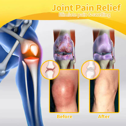 🐝[Official Store] Flysmus™ Bee-Venom Pain-Relief Bone Healing Cream👨‍⚕️Approved by the American Osteopathic Association (AAOS)（复制）