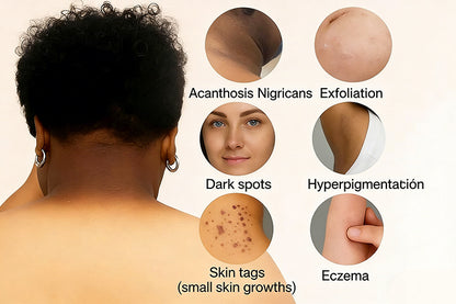 Seurico Orange Gel Exfoliant Goodbye Dark Spots & Roughness
