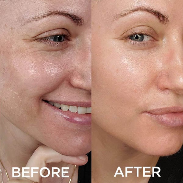 🎉🔥Mother's Day Promotion 49% OFF - 🔥Anti-aging Spot-lightening Essence