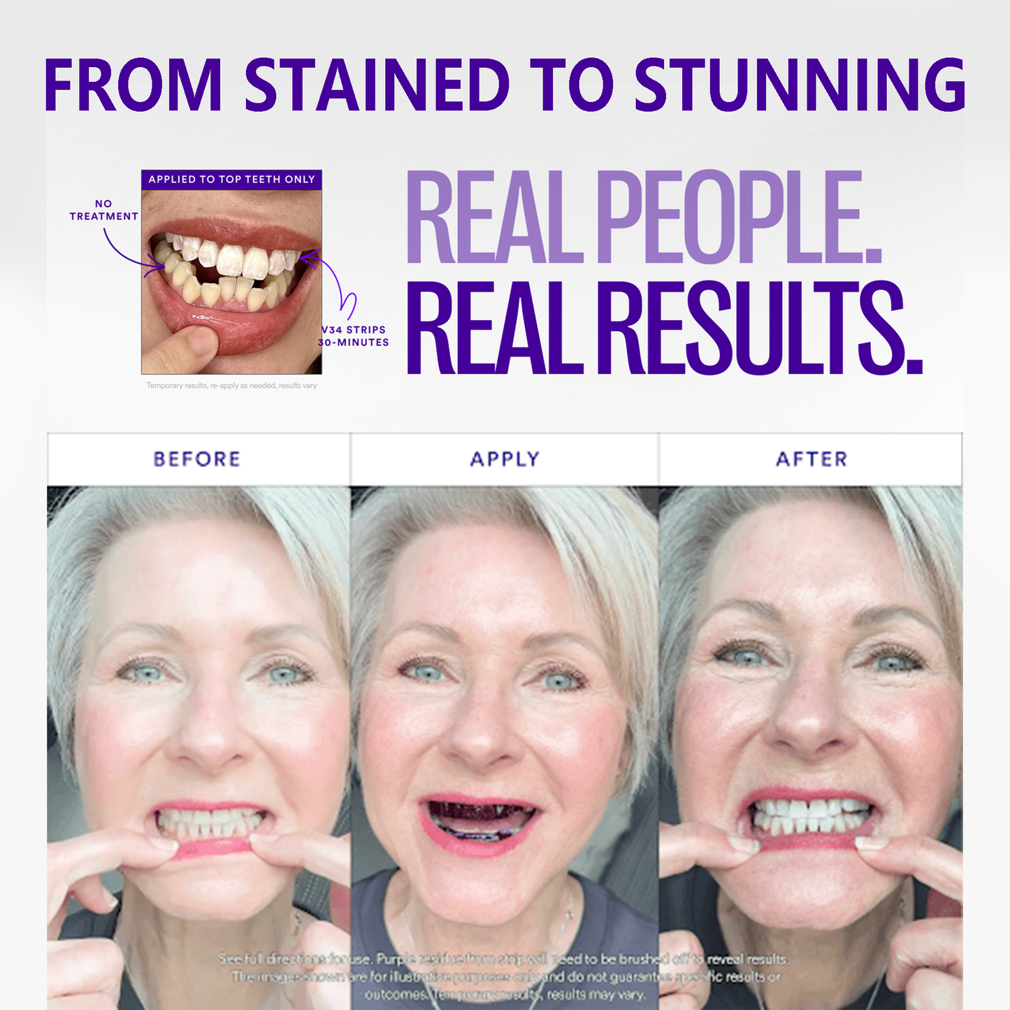 🦷V36 Whitening Strips – Professional Teeth Whitening at Home