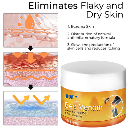 （🍀 Last Day 80% Off🍀）AQA™ Bee Venom  Therapy Cream