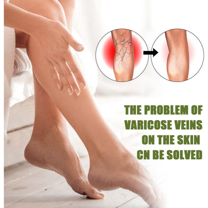 Seurico™ Varicose Veins Spray
