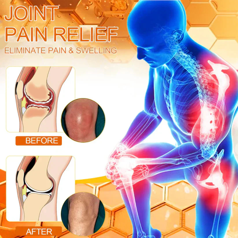 🐝[Official Store] ODEIUN Bee-Venom Pain-Relief Bone Healing Cream👨‍⚕️Approved by the American Osteopathic Association (AAOS)