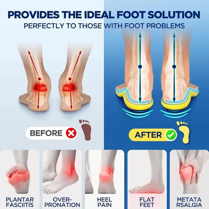 All-Day Comfort Insoles with Shock Absorption & High Arch Support