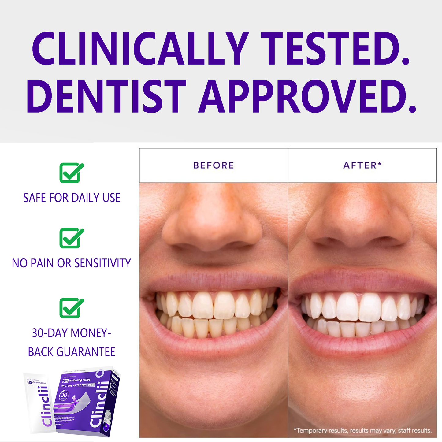 🦷V36 Whitening Strips – Professional Teeth Whitening at Home