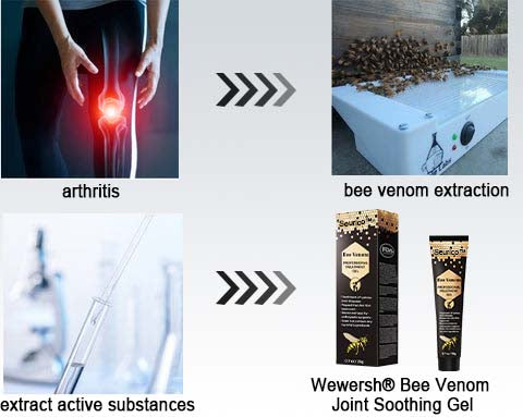 🐝New Zealand Bee Venom Joint Relief Gel(New Zealand Bee Extract - Specializes in the treatment of orthopedic conditions and arthritic pain) 🐝