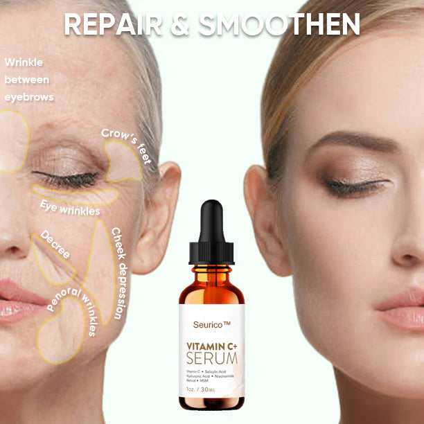 Seurico™ Vitamin C Anti Aging for Face Serum 🔥 - Last Day Promotion 70% OFF