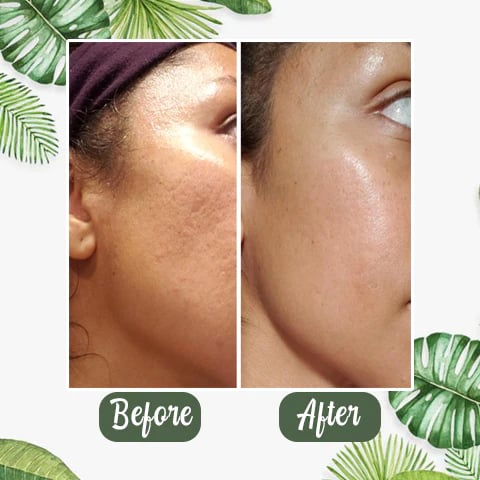 🔥Hot Sale 49% OFF - Deep Cleanse Green Tea Mask