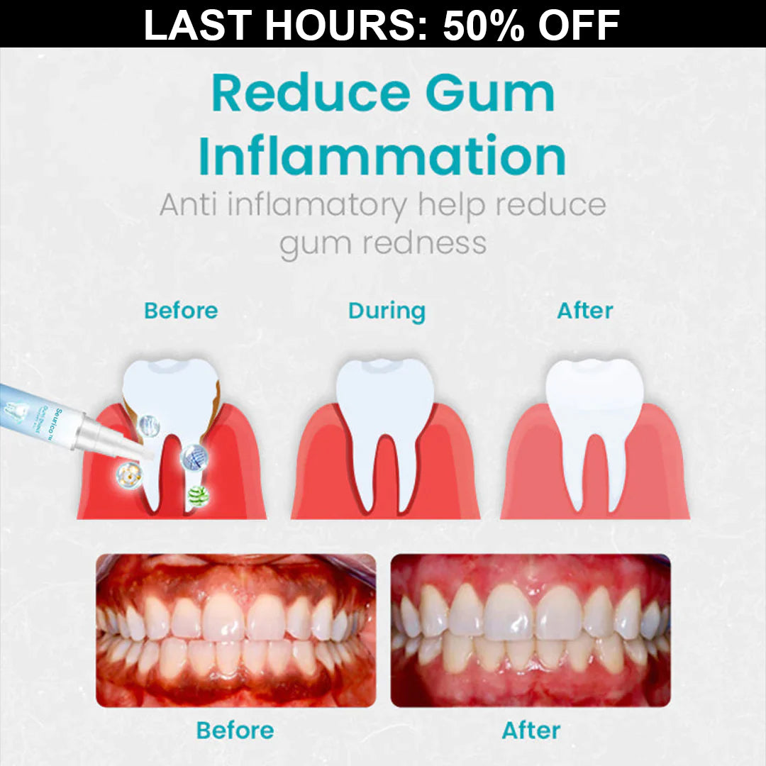 🎄Christmas Pre-sale 50% OFF-Seurico™  Gum Shield Therapy Gel
