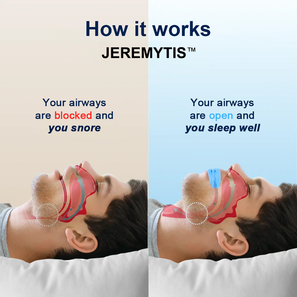 🔥JEREMYTIS™  Professional intelligent anti-snoring device