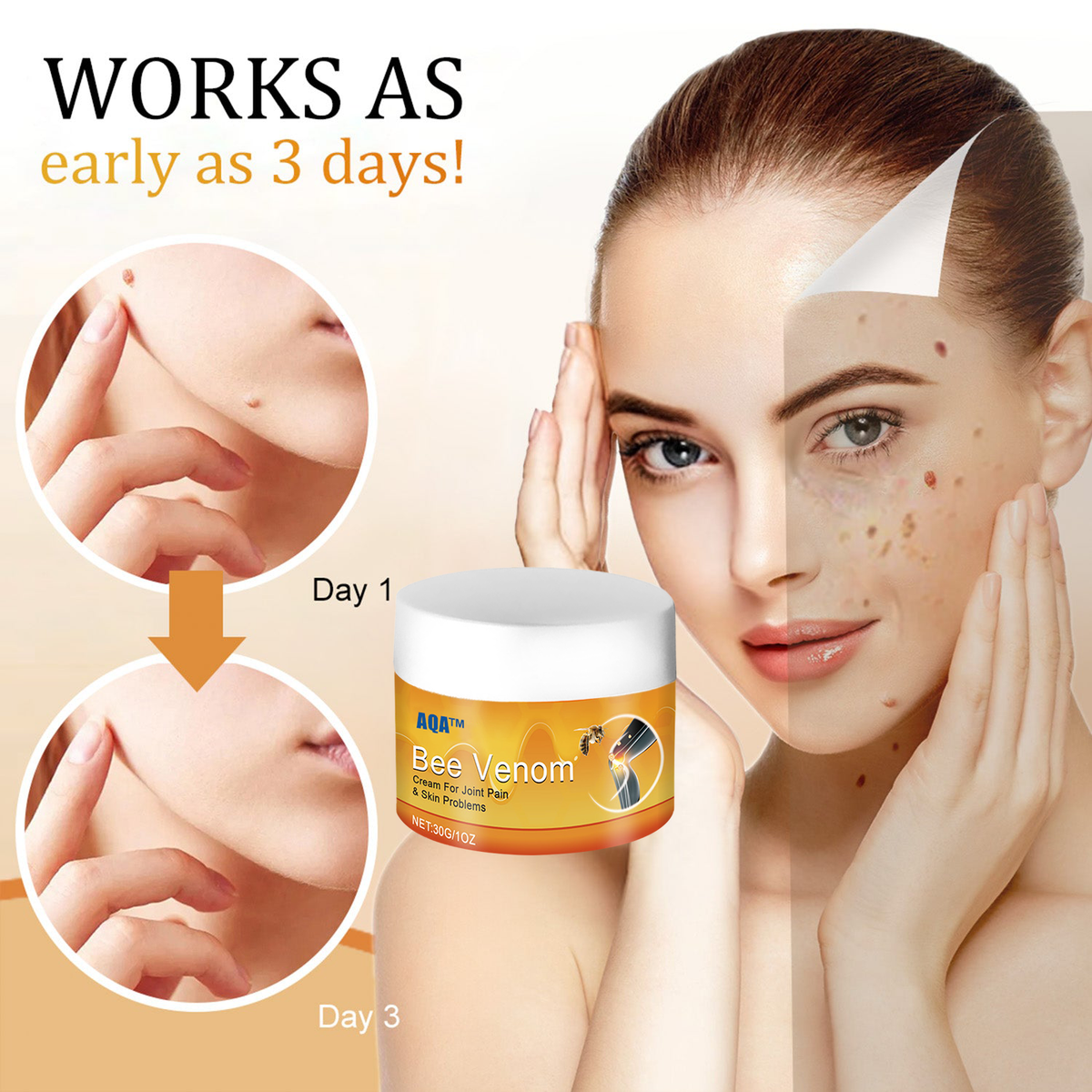 （🍀 Last Day 80% Off🍀）AQA™ Bee Venom  Therapy Cream