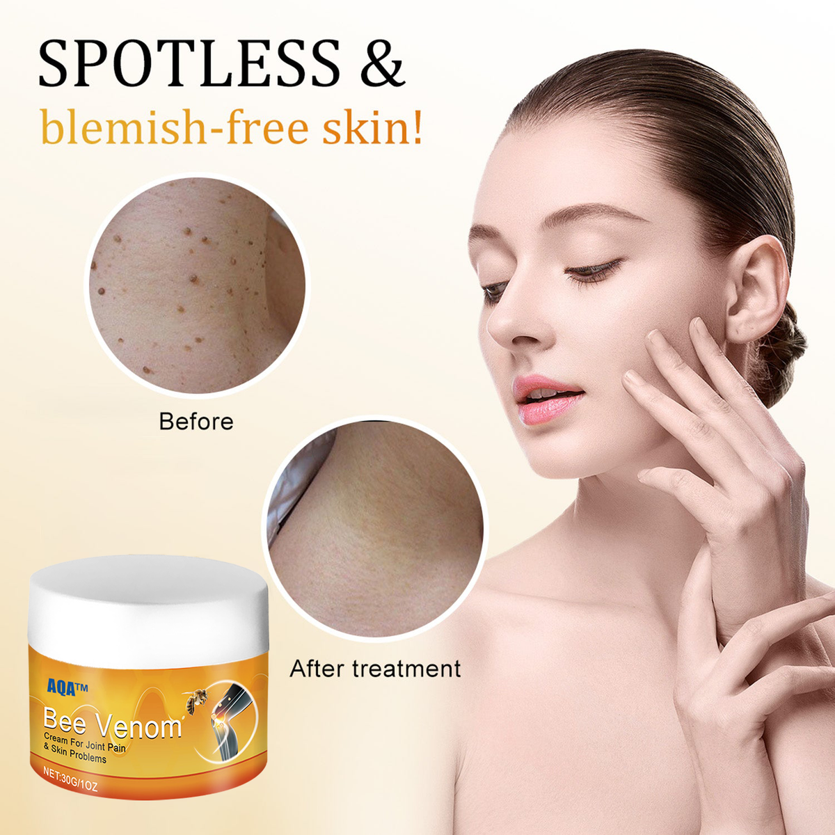 （🍀 Last Day 80% Off🍀）AQA™ Bee Venom  Therapy Cream