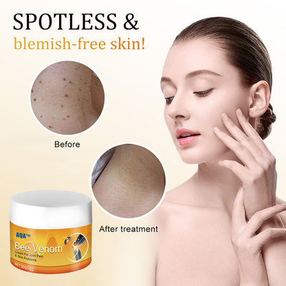 （🍀 Last Day 80% Off🍀）AQA™ Bee Venom  Therapy Cream