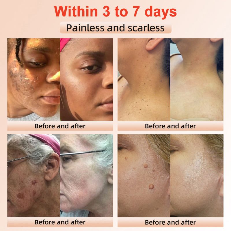 ✨[Official Store]JEREMYTIS™ Exfoliating Gel