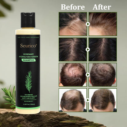🔥Seurico Organic Rosemary Hair Growth Shampoo & Hair Conditioner