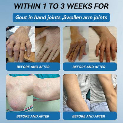 🇬🇧𝐟𝐥𝐲𝐬𝐦𝐮𝐬® 𝐁𝐏𝐂-𝟏𝟓𝟕 𝐉𝐨𝐢𝐧𝐭 𝐇𝐞𝐚𝐥𝐢𝐧𝐠 𝐂𝐫𝐞𝐚𝐦🦴Treats Arthritis, Neuropathy, Rheumatism, Sports Injuries & More🇬🇧🏆