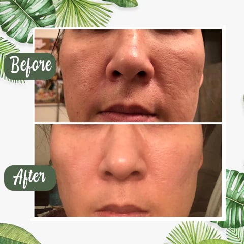 🔥Hot Sale 49% OFF - Deep Cleanse Green Tea Mask