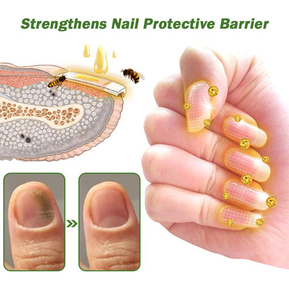 🐝Seurico™ Nail Defense Bee Venom Treatment Serum pro