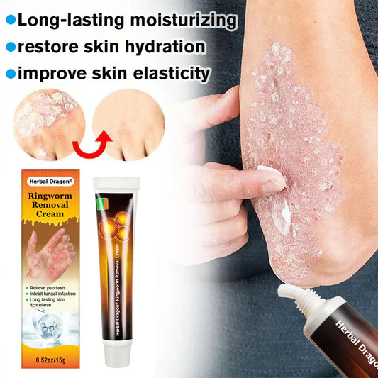 Herbal Dragon® Ringworm Removal Cream