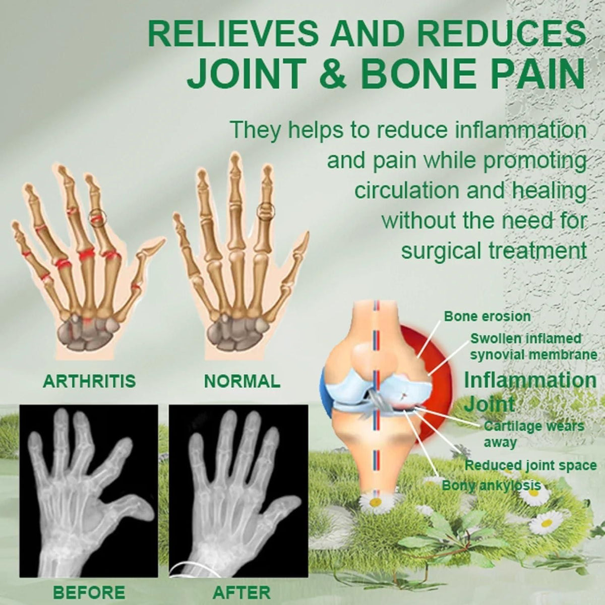 Bee Venom Joint and Bone Therapy Cream™️
