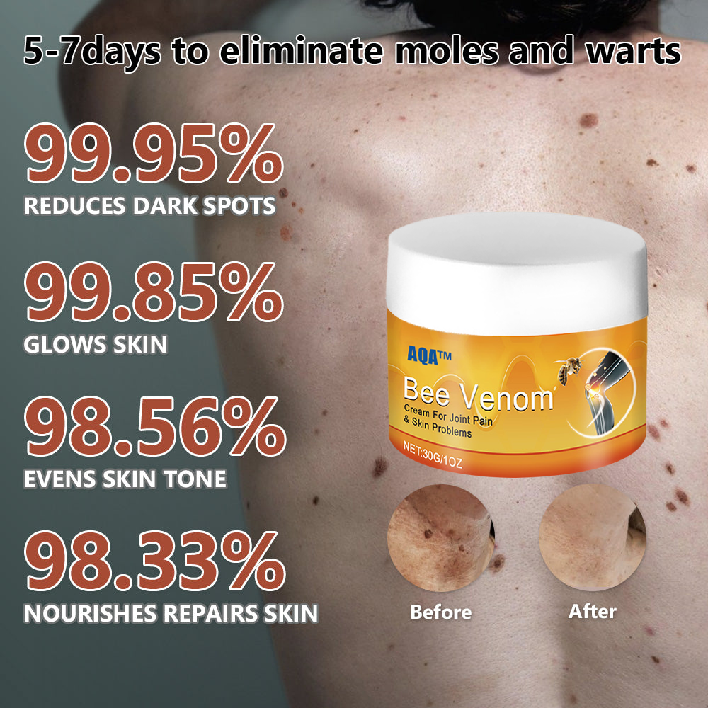 （🍀 Last Day 80% Off🍀）AQA™ Bee Venom  Therapy Cream