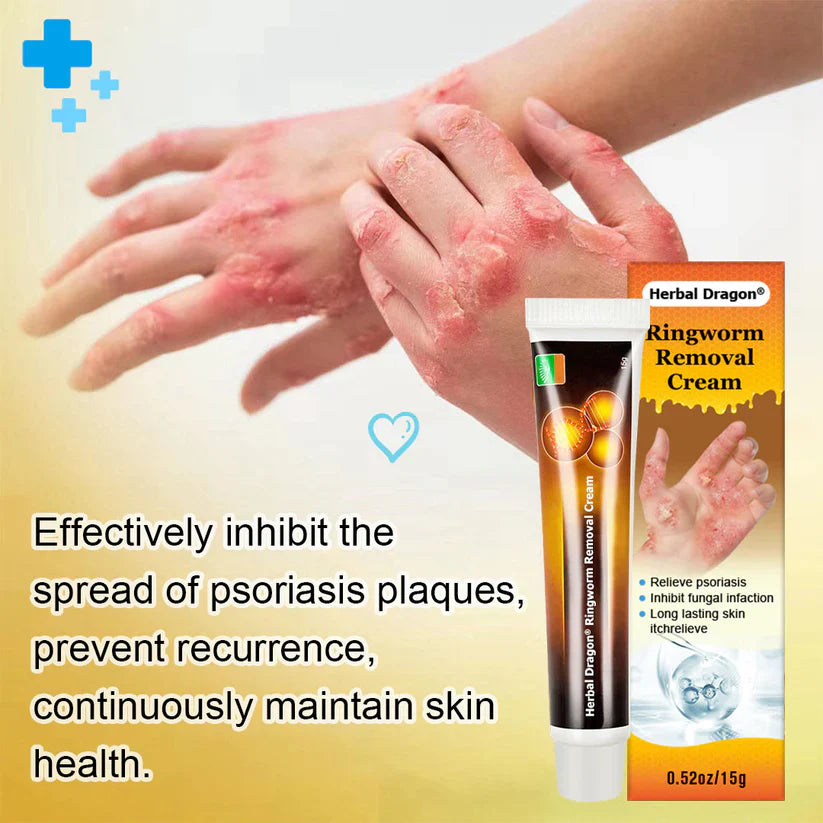 Herbal Dragon® Ringworm Removal Cream