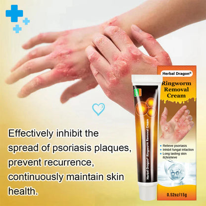 Herbal Dragon® Ringworm Removal Cream