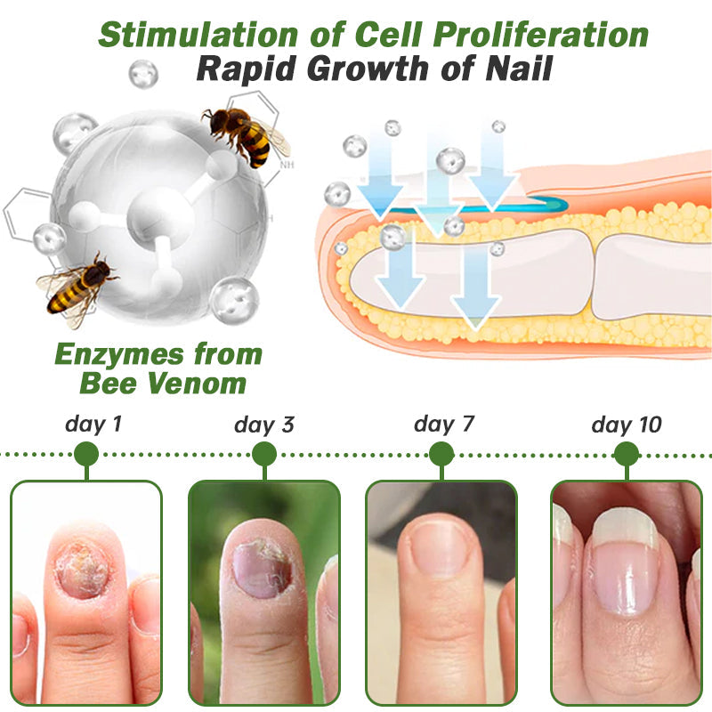 🐝Seurico™ Nail Defense Bee Venom Treatment Serum pro