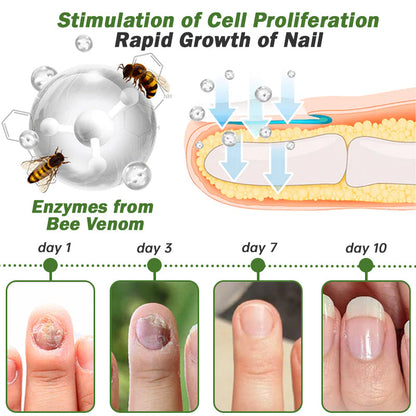 🐝Seurico™ Nail Defense Bee Venom Treatment Serum pro