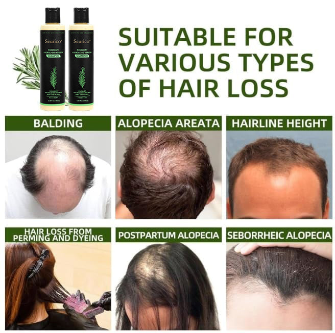 🔥Seurico Organic Rosemary Hair Growth Shampoo & Hair Conditioner