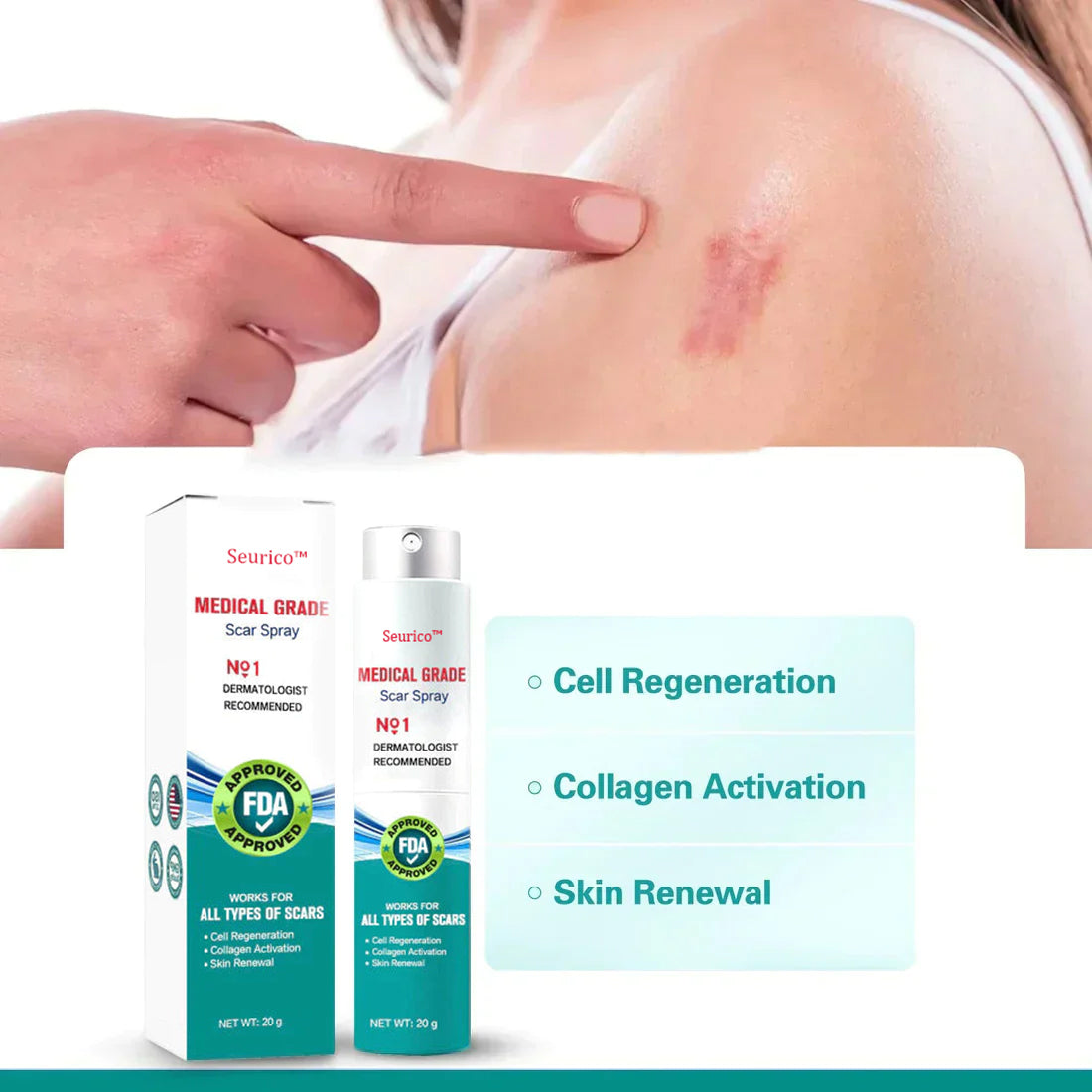 Seurico™ Advanced Scar Remove Spray（For example Acne Scars, Surgical Scars and Stretch Marks ）