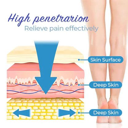 Seurico™ Varicose Veins Spray
