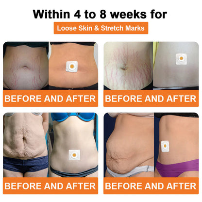 🐝Daasry™ Bee Venom Lymphatic Drainage Slimming Patch
