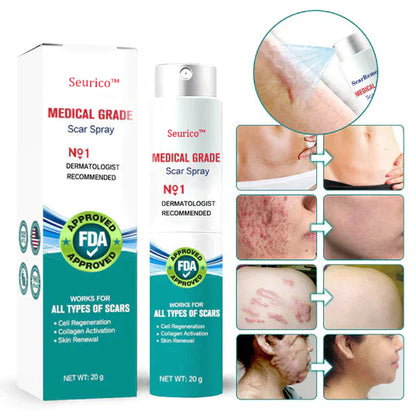 Seurico™ Advanced Scar Remove Spray（For example Acne Scars, Surgical Scars and Stretch Marks ）