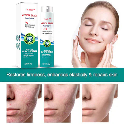 Seurico™ Advanced Scar Remove Spray（For example Acne Scars, Surgical Scars and Stretch Marks ）