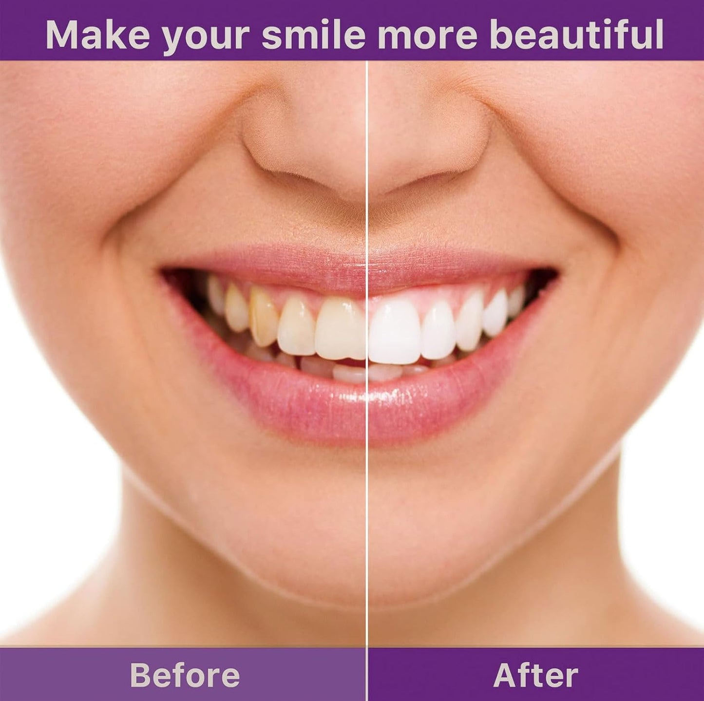 🦷V36 Whitening Strips – Professional Teeth Whitening at Home