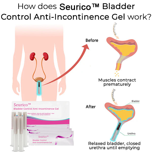 Seurico™ Bladder Control Anti-Incontinence Gel