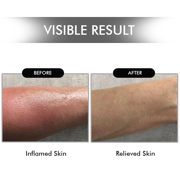 Seurico™ HealRay Red Light Recovery Wand