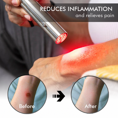 Seurico™ HealRay Red Light Recovery Wand